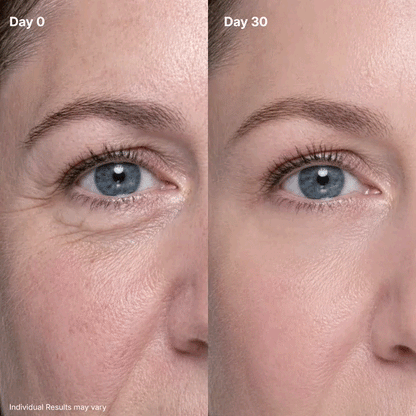 🔥Final 2 Hour 76% OFF🔥 P7 Eye Renewal Crème